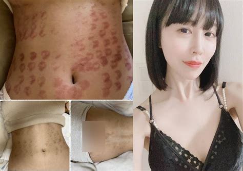 riri hosho|Japanese AV star Riri Hosho reveals she suffered burns across。